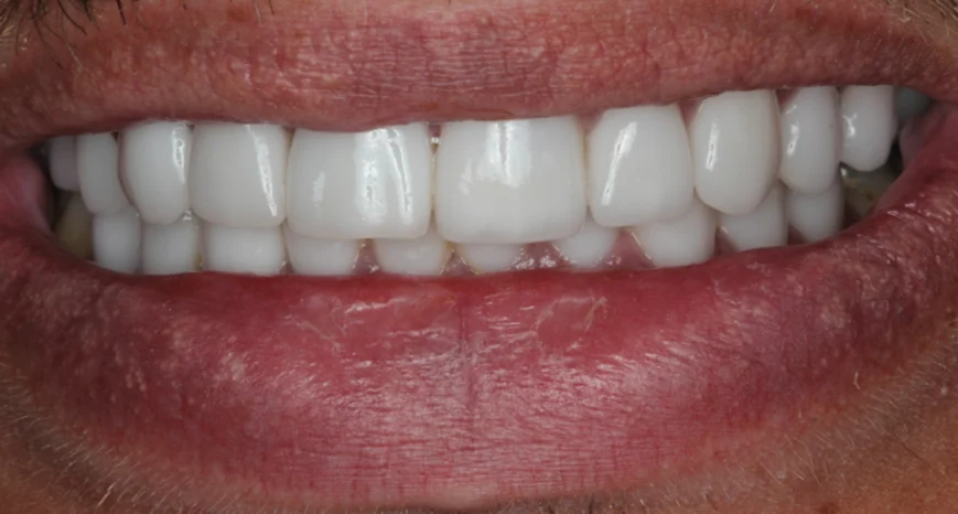 smile2